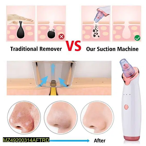 Black Heads remover and skin cleanser